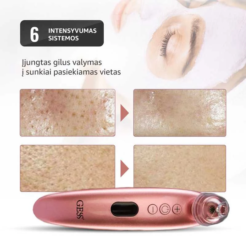 GESS SLEEK BLACKHEAD DULKUMINIS SUSIurbiklis SU KAMEROS