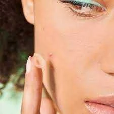 Iroha Nature Hydrocolloide Face & Body SOS Pimple Patches hidrokoloidiniai pleistrai nuo spuogų su salicilio rūgštimi, 1 vnt.