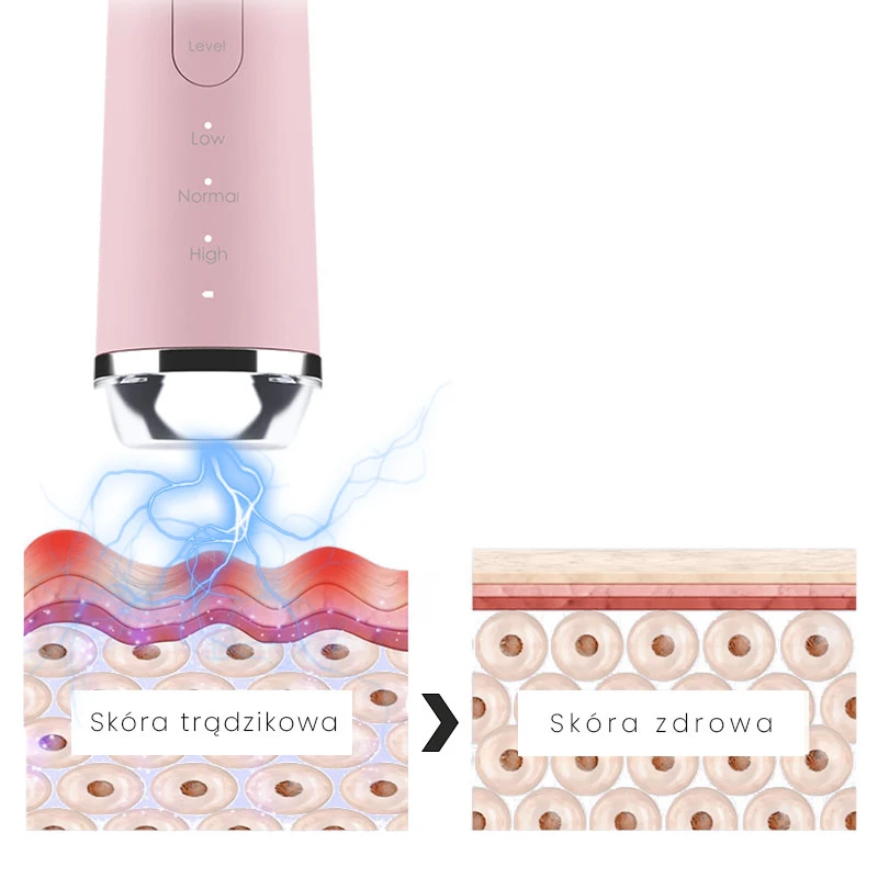 Mezoterapija Beautifly B-Plasma Blush aprašymas - Prekės nuotrauka
