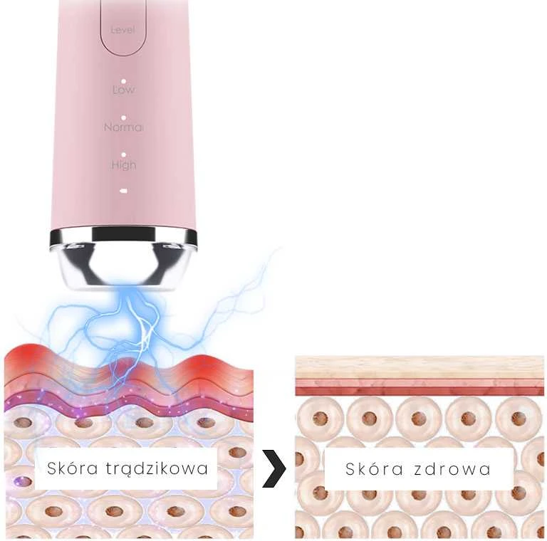 Mezoterapija Beautifly B-Plasma Blush