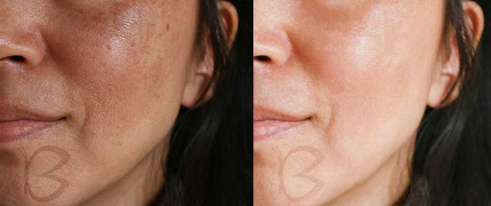 Veido val. pr. Beautifly B-SCRUB PRO