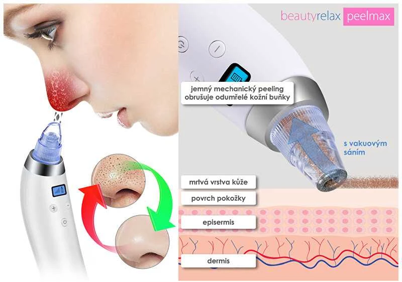 Beauté Relax BeautyRelax Kosmetinis odos šlifavimo prietaisas "Peelmax