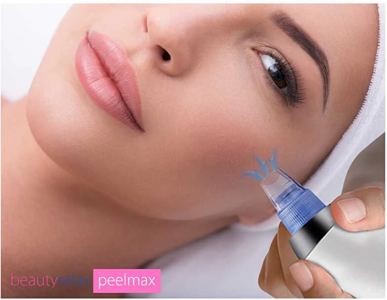 Beauté Relax BeautyRelax Kosmetinis odos šlifavimo prietaisas "Peelmax