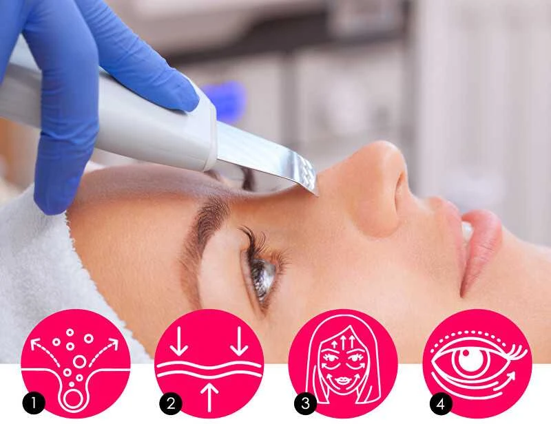 Beauty Relax „BeautyRelax“ ultragarsinė mentelė „Peel & Lift Premium“ baltai BR-1530
