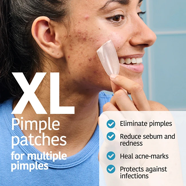 Iroha ACNE PRONE SKIN hidrokoloidinės pleistrys XL 5 vnt.