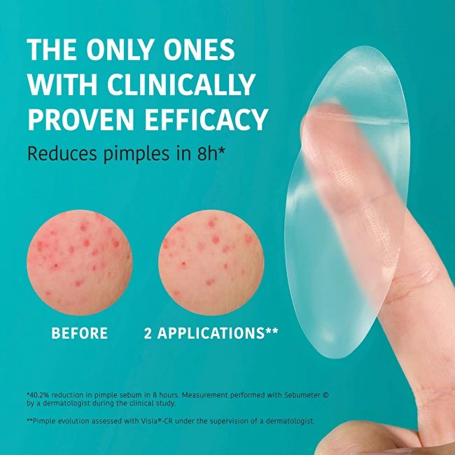 Iroha ACNE PRONE SKIN hidrokoloidinės pleistrys XL 5 vnt.
