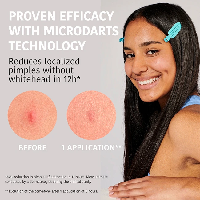 Iroha ACNE PRONE SKIN Microdart Pimple Patches with Salicylic Acid 12 Units