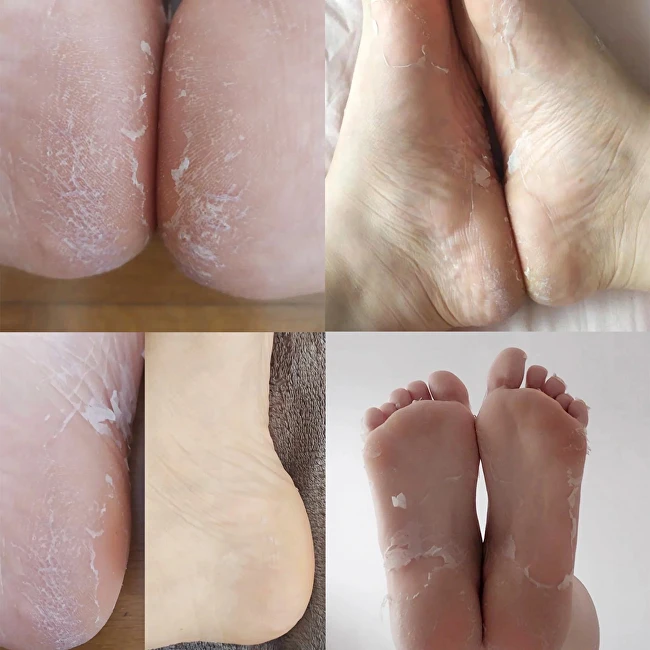 Profesionali kaukė pėdoms Iroha Exfoliating Lavender Foot Socks su levandomis, 1 pora