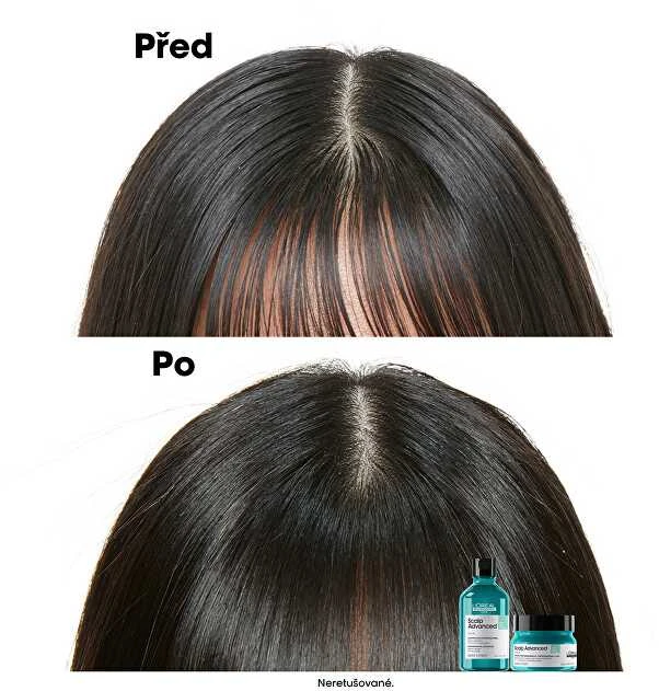 Valomoji kaukė - šampūnas riebiai galvos odai L'oreal Professionnel Scalp Advanced Anti-Oiliness 2-In-1 Deep Purifier Clay 250ml