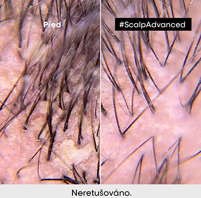 Valomoji kaukė - šampūnas riebiai galvos odai L'oreal Professionnel Scalp Advanced Anti-Oiliness 2-In-1 Deep Purifier Clay 250ml