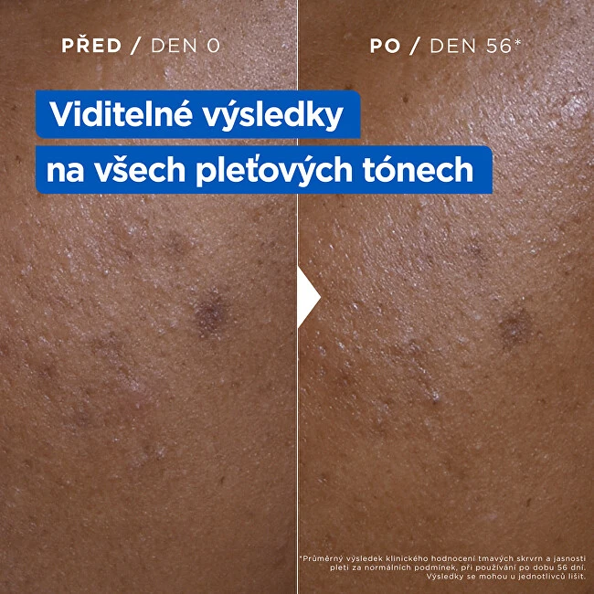 Mixa Niacinamide Bright Moisturizing Anti-Dark Spot Kreminis Body Kreminis