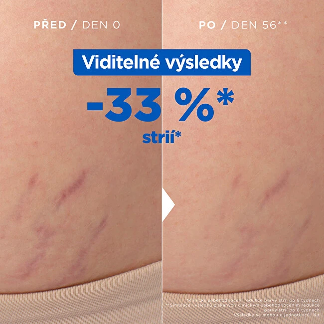 Mixa Stretch Mark Oil kūno aliejus nuo strijų, 100 ml