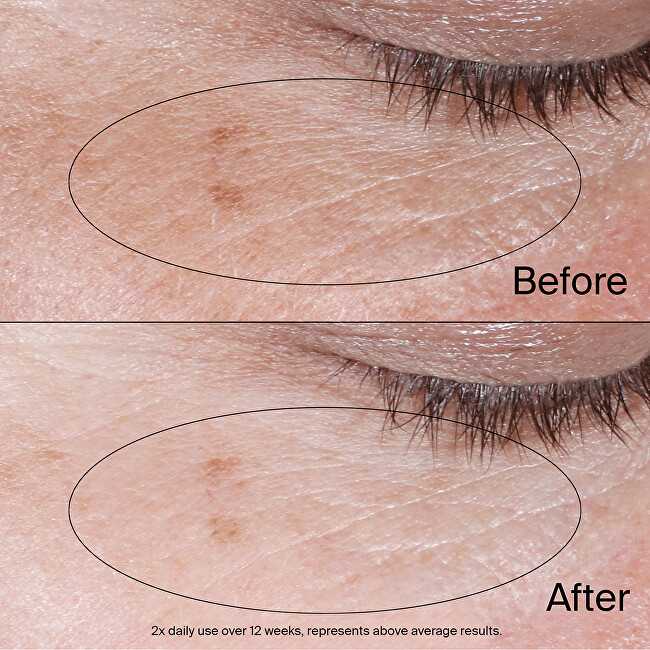 Johnson NEUTROGENA Collagen Bank atgaivinantis paakių gelinis kremas