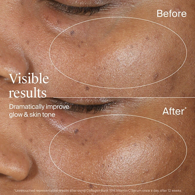 Neutrogena Collagen Bank Serum with Vitamin C 15 ml