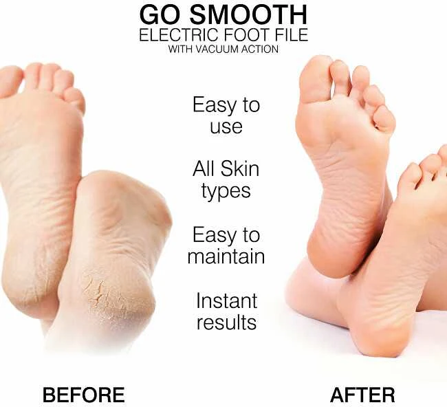 Rio-Beauty Go Smooth electric foot file with vacuum suction kojų nagų priežiūros priemonė Unisex