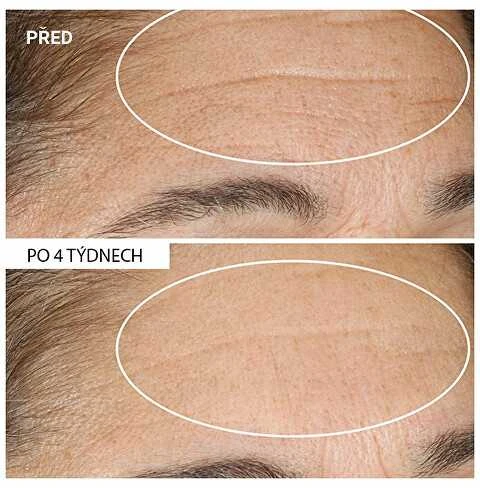 „StriVectin Advanced Retinol“ naktinis atsinaujinantis drėkiklis, 30 ml