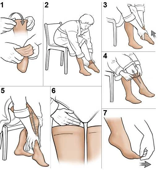 Danwa Medicininės Kompresinės Kojinės II Klasė Iki Šlaunies SABO 20-30 mmHg, Unisex, Atvirais Pirštais, Juodos