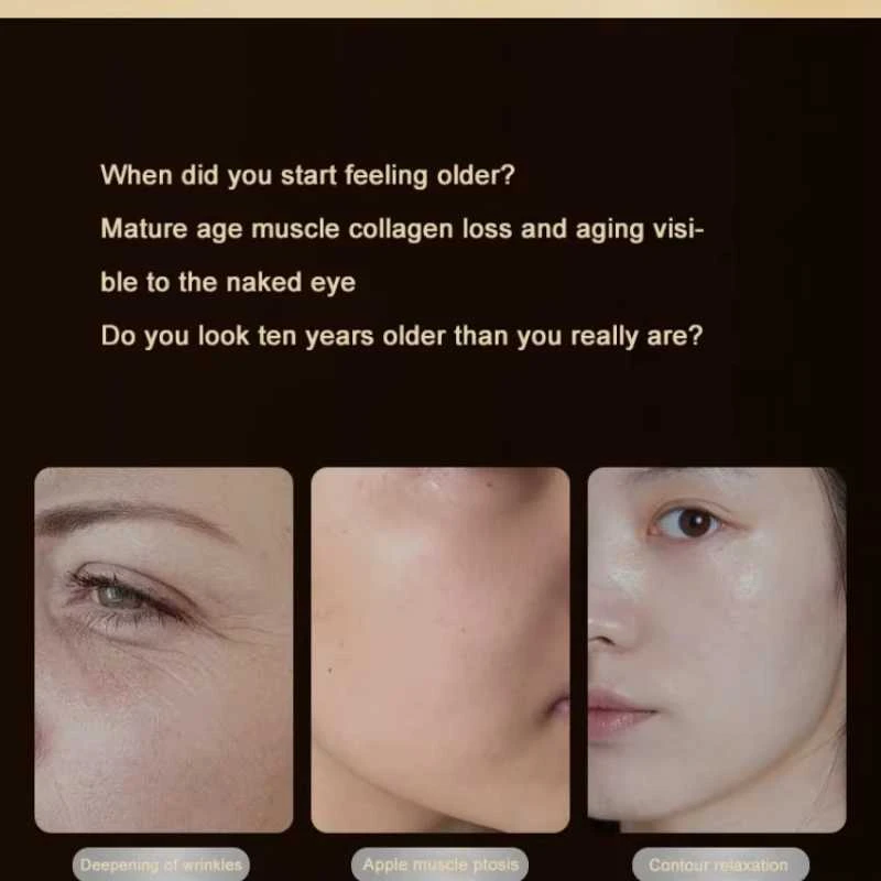 Collagen RF Veido masažuoklis su raudona šviesa – stangrinantis & anti-senėjimo prietaisas