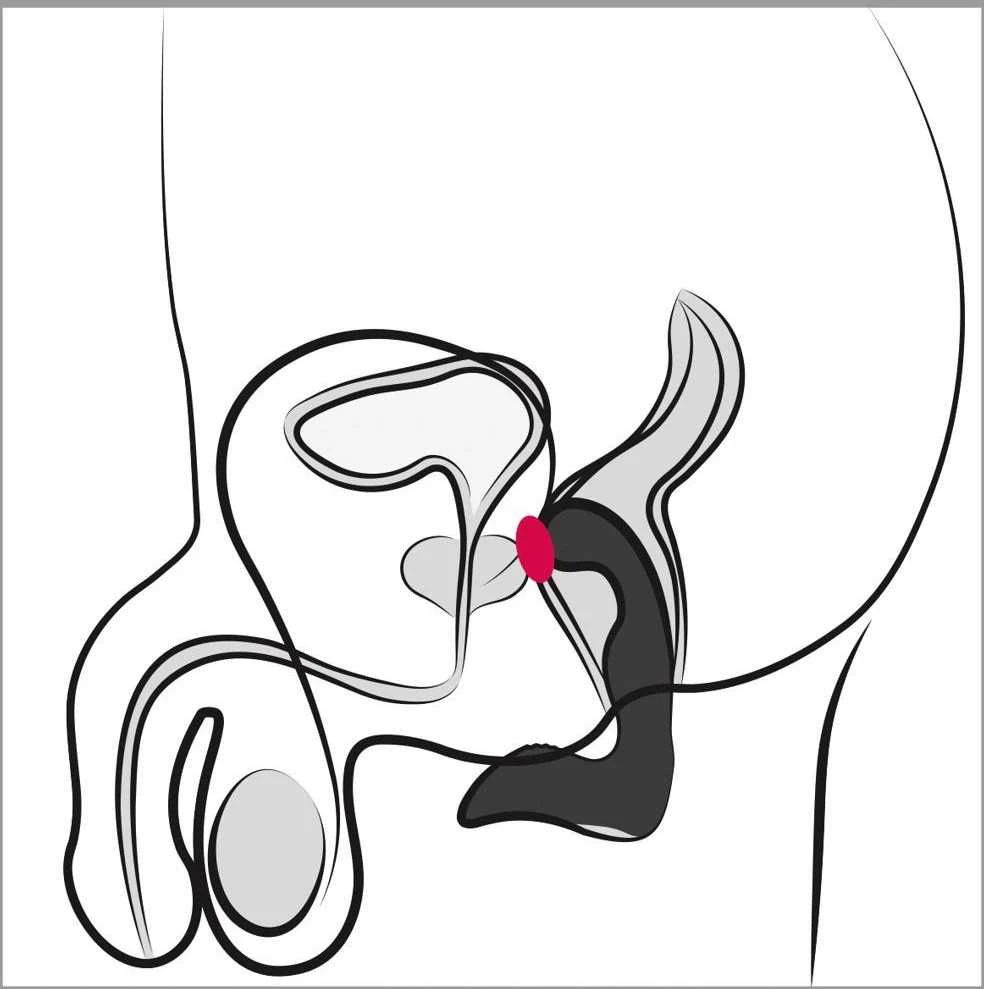 Rebel Prostate Plug recharge