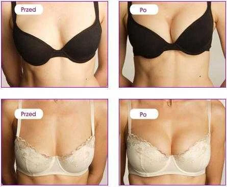 SHS Sexual Health Series Perfect Bust Intensive Bust Firming Gel krūtų didinimui 150ml