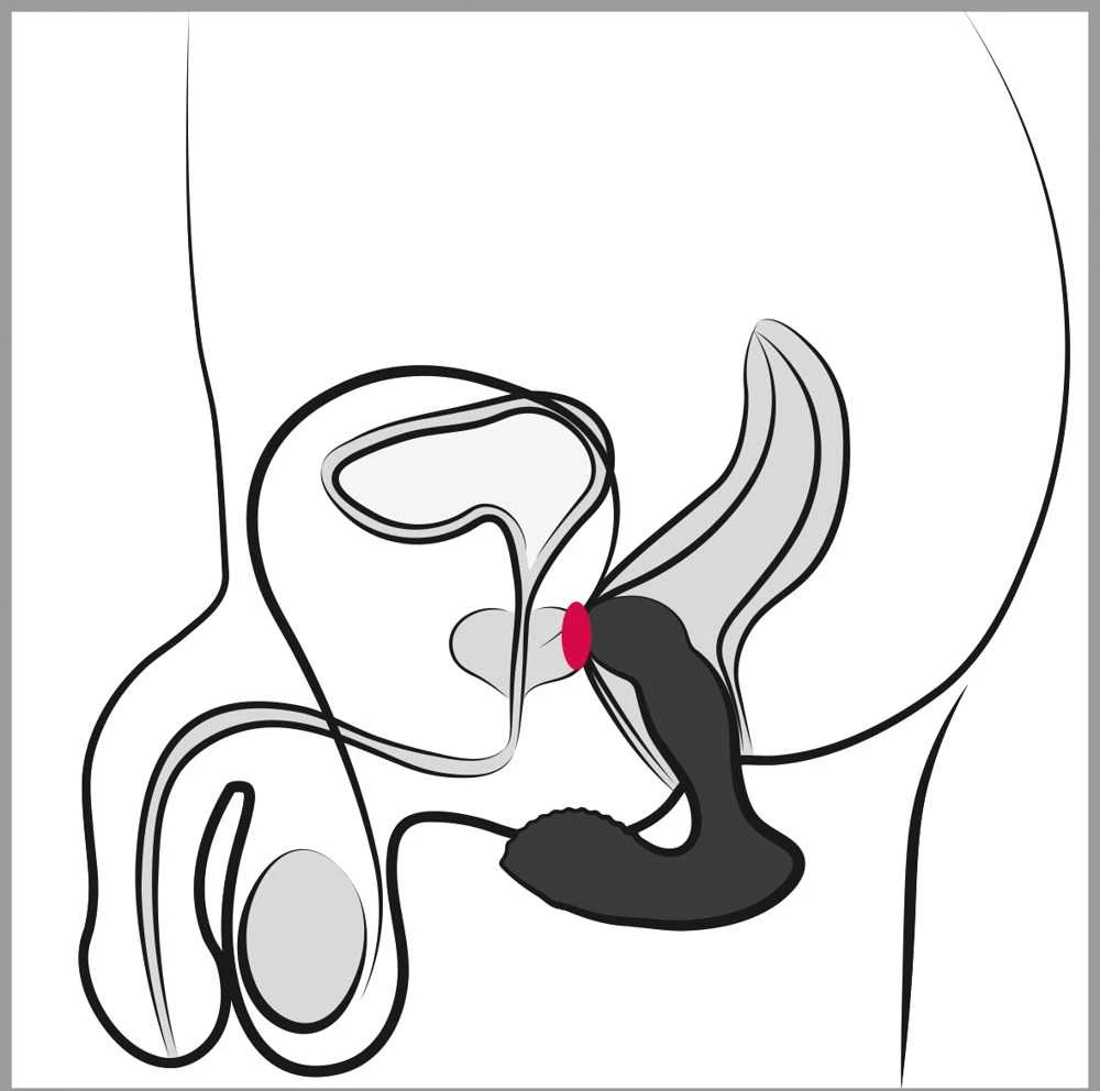 Rebel RC Prostate Massager