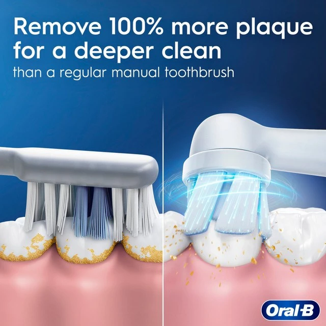 Dantų šepetėlis Oral-B iO 2 Forest Žalias + Dėklas žalia