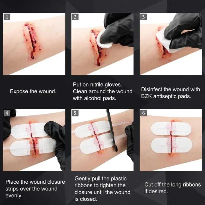 Rhino Rescue Wound Care Kit – Žaizdų užvėrimo rinkinys