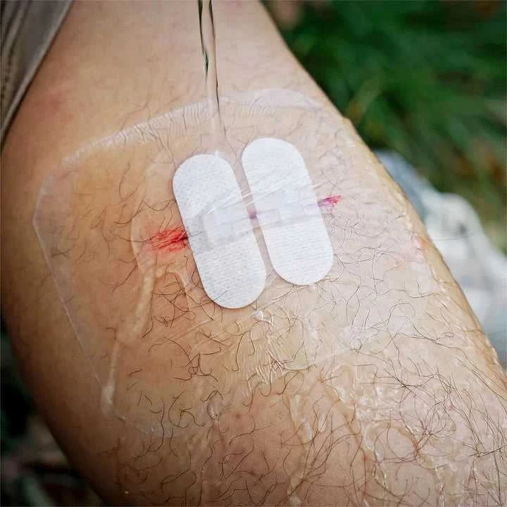 Rhino Rescue Wound Care Kit – Žaizdų užvėrimo rinkinys