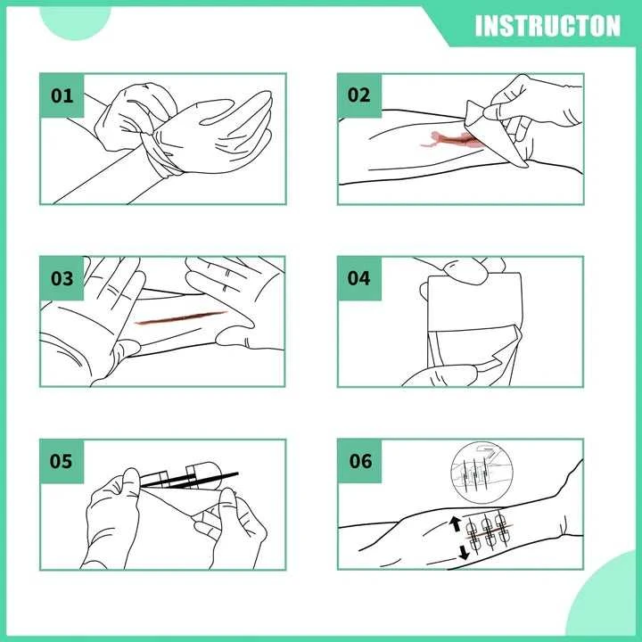 Rhino Rescue Wound Care Kit – Žaizdų užvėrimo rinkinys