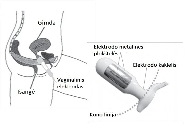 Dubens dugno raumenų stimuliacijos aparatas NeuroTrac CONTINENCE