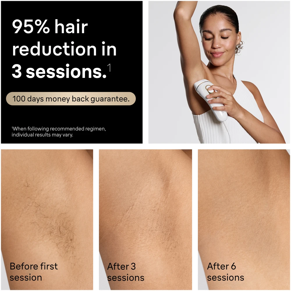 Braun PL5431 Silk-expert Pro 5 IPL fotoepiliatorius