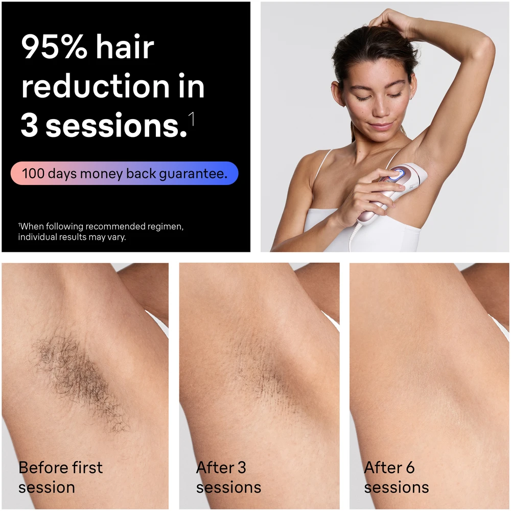 NAUJIENA Braun PL7321 Skin i·expert Pro7 IPL Fotoepiliatorius - Išmanioji alternatyva lazeriui.