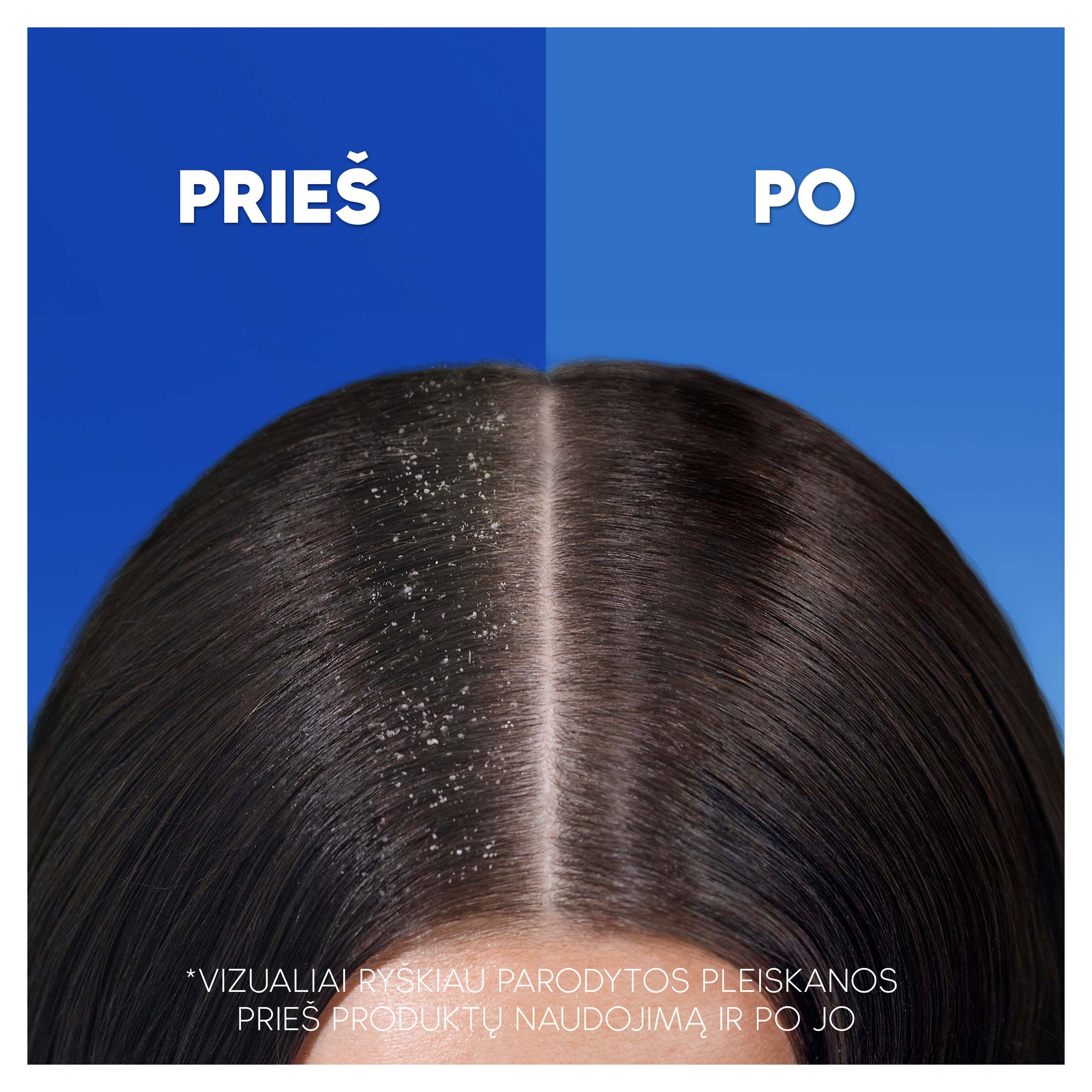 Head&Shoulders Head & Shoulders šampūnas plaukams, suteikiantis blizgesio ir suteikiantis švytėjimo, 800 ml aprašymas - Prekės nuotrauka