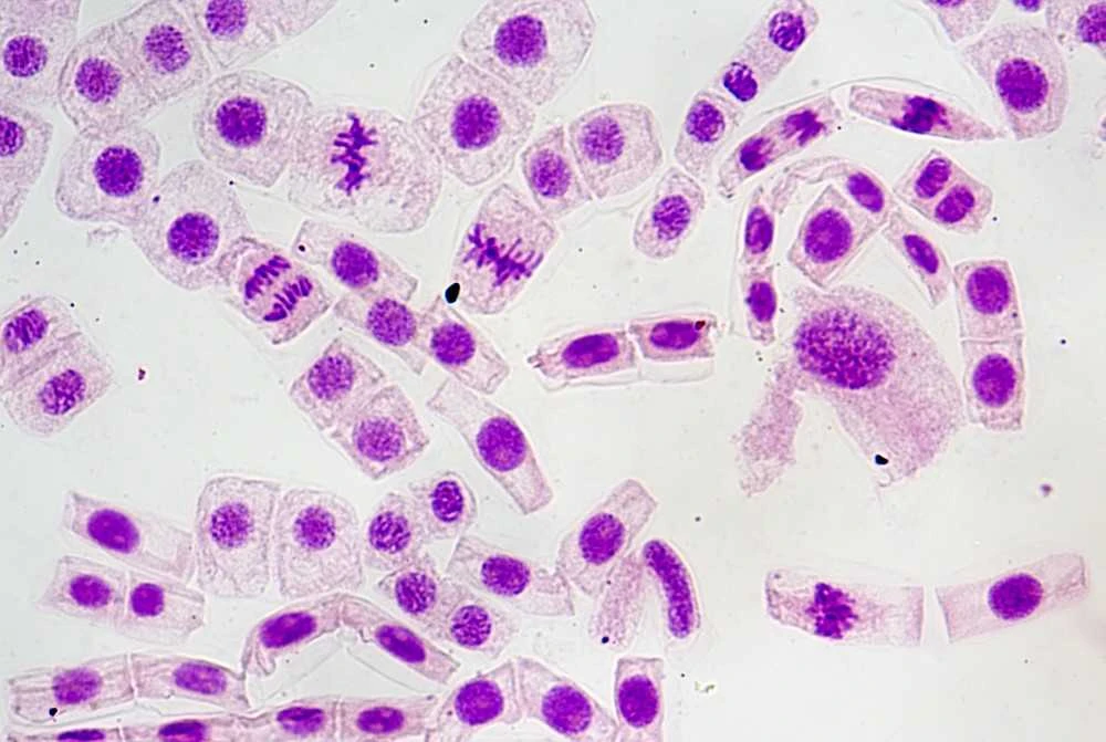 Deltaoptical Mikroskopas ProteOne
