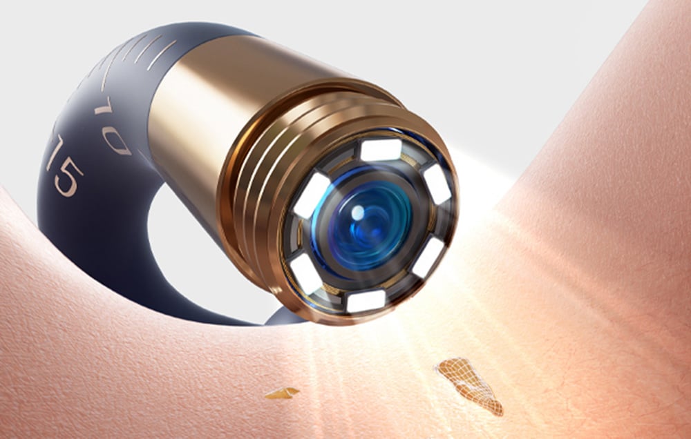 Išmanusis laikrodis Bebird EarSight Plus otoskopas su ausų valymo kamera (mėlynas) aprašymas - Prekės nuotrauka Išmanusis laikrodis Bebird EarSight Plus otoskopas su ausų valymo kamera (mėlynas) aprašymas - Prekės nuotrauka