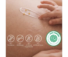 MOMCOZY STANGRINAMASIS KŪNO KREMAS NUO STRIJŲ SU KOLAGENU, 30 G
