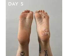 maskology FOOT PEEL Professional Foot Treatment nulupamoji pėdų kaukė-kojinės, 1 pora