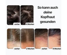 R&amp;DETAIL Skin Caring Šampūnas odą puoselėjantis šampūnas, 100 ml
