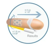 Andromedical Androextender