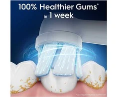 Oral-B iO Gentle Care dantų šepetėlio galvutė, 6 vnt.