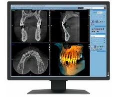 Monitorius Eizo 21" MX217-SB
