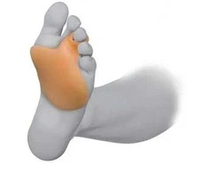 "Prim Comforsil Metatarsal Pad