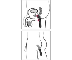 Rebel P-Spot vibratorius