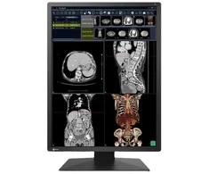 Monitorius EIZO RadiForce RX270, 54.1 cm (21.3"), 1200 x 1600 pikselių, UXGA, LCD, 20 ms, Juodas, Baltas