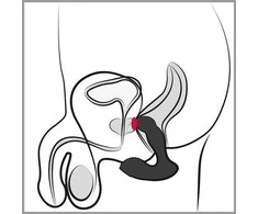 Rebel RC Prostate Massager
