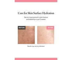Medicube PDRN Rožinė Glutathione Serum Mist – purškiamas veido serumas su PDRN 100 ml