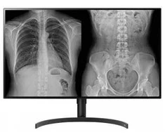 LG DIAGNOSTIC MONITORIUS, 31.5", 8MP, 450CD/M2, DCI-P3 98%, HAS/PIVOT.