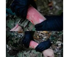 Rhino Rescue Burn Care Kit – vieno žingsnio skubus nudegimų gydymas