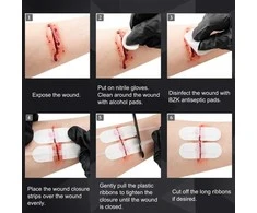 Rhino Rescue Wound Care Kit – Žaizdų užvėrimo rinkinys
