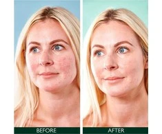 Sorted Skin – 5 viename dieninis kremas nuo paraudimo – SPF50 30 ml